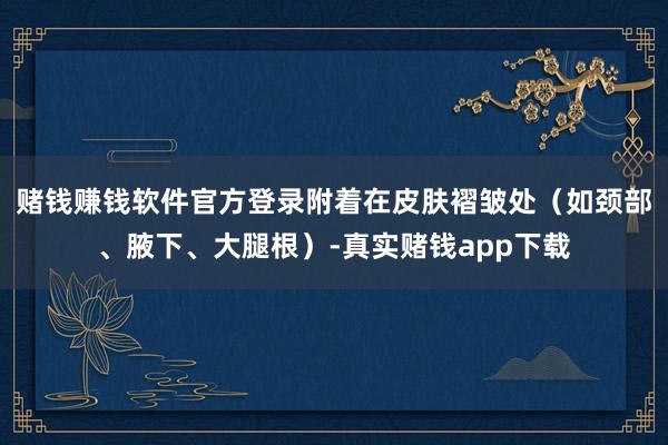 赌钱赚钱软件官方登录附着在皮肤褶皱处（如颈部、腋下、大腿根）-真实赌钱app下载